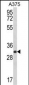 DERA Antibody (N-term)